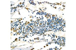 Immunohistochemistry of paraffin embedded mouse bone using CD110 (ABIN7074718) at dilution of 1:1000 (400x lens) (MPL 抗体)