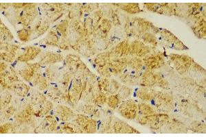 Immunohistochemistry of paraffin-embedded Mouse heart using ACTN1 Polyclonal Antibody at dilution of 1:100 (40x lens). (ACTN1 抗体)