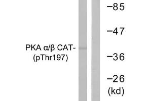 Western blot analysis of extracts from mouse brain cells using PKA α/β CAT (Phospho-Thr197) Antibody.