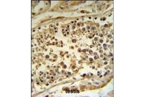 HFE Antibody (Center) (ABIN390457 and ABIN2840827) IHC analysis in formalin fixed and paraffin embedded human testis tissue followed by peroxidase conjugation of the secondary antibody and DAB staining. (HFE 抗体  (AA 122-148))