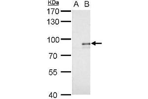 WB Image Alkyl-DHAP synthase antibody detects Alkyl-DHAP synthase protein by western blot analysis. (AGPS 抗体)