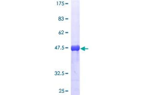 RAB5 Protein (AA 1-215) (GST tag)