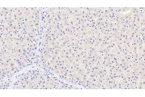 Detection of TDO in Human Liver Tissue using Monoclonal Antibody to Tryptophan-2,3-dioxygenase (TDO) (TDO2 抗体  (AA 1-406))