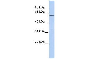 C6ORF182 antibody used at 1 ug/ml to detect target protein. (CEP57L1 抗体  (Middle Region))