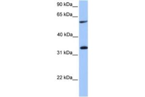 Western Blotting (WB) image for anti-Testis-Specific serine Kinase Substrate (TSKS) antibody (ABIN2463605) (TSKS 抗体)
