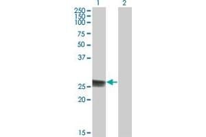 Western Blot analysis of TK1 expression in transfected 293T cell line by TK1 monoclonal antibody (M05), clone 3F9. (TK1 抗体  (AA 1-234))