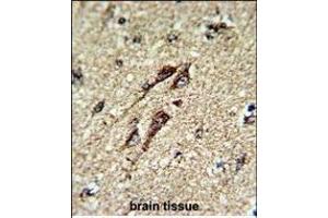 Immunohistochemistry (Paraffin-embedded Sections) (IHC (p)) image for anti-ATP Synthase, H+ Transporting, Mitochondrial F1 Complex, beta Polypeptide (ATP5B) (AA 135-163) antibody (ABIN650786)