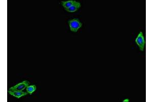 Immunofluorescent analysis of HepG2 cells using ABIN7153773 at dilution of 1:100 and Alexa Fluor 488-congugated AffiniPure Goat Anti-Rabbit IgG(H+L) (GMIP 抗体  (AA 719-858))
