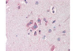 Anti-FBXL2 antibody IHC staining of human brain, cortex. (FBXL2 抗体  (AA 2-14))