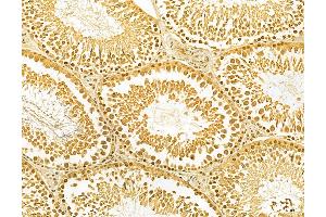 ABIN6263265 and ABIN6268849 at 1/100 staining Rat testis tissue by IHC-P. (MKL1 抗体  (N-Term))