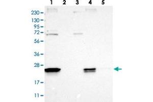 Western blot analysis of Lane 1: RT-4, Lane 2: Human Plasma, Lane 3: U-251 MG, Lane 4: Liver, Lane 5: Tonsil with FAM213A polyclonal antibody . (FAM213A 抗体)