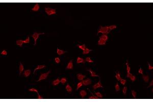 ABIN6272303 staining MDA-MB-435 by IF/ICC. (PMP22 抗体  (C-Term))