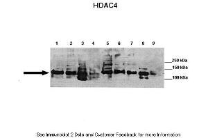 Lanes:   Lane 1: 40ug mouse brain, synaptosome lysate  Lane 2: 40ug mouse brain, membrane fraction  Lane 3: 40ug mouse brain, cytoplasm fraction  Lane 4: 40ug mouse brain, nuclear fraction  Lane 5: 40ug mouse brain, post synaptic density fraction  Lane 6: 40ug mouse brain, synaptosome lysate  Lane 7: 40ug mouse brain, membrane fraction  Lane 8: 40ug mouse brain, cytoplasm fraction  Lane 9: 40ug mouse brain, nuclear fraction   Primary Antibody Dilution:   1:1000  Secondary Antibody:   Goat anti-rabbit HRP  Secondary Antibody Dilution:   1:2000  Gene Name:   Hdac4  Submitted by:   Wen-Cheng Xiong, Georgia Health Sciences University (HDAC4 抗体  (C-Term))