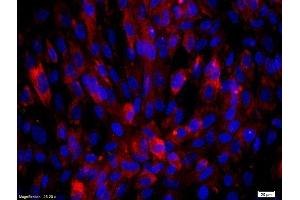 Human endothelial cells labeled with Rabbit Anti-Biglycan Polyclonal Antibody, Unconjugated  was used to stain the cell nuclei (Biglycan 抗体  (AA 101-200))