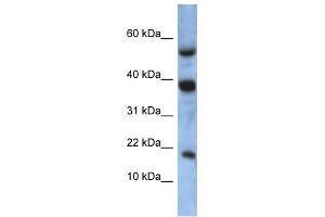 ATXN7L1 antibody used at 1 ug/ml to detect target protein. (ATXN7L1 抗体  (Middle Region))