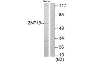 Western blot analysis of extracts from HeLa cells, using ZNF18 Antibody. (ZNF18 抗体  (AA 261-310))