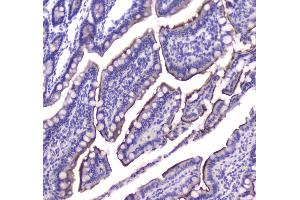 IHC analysis of Cannabinoid Receptor I using anti-Cannabinoid Receptor I antibody . (CNR1 抗体  (AA 1-75))