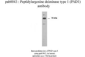Image no. 2 for anti-Peptidyl Arginine Deiminase, Type I (PADI1) antibody (ABIN346990) (PADI1 抗体)