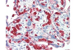 Anti-Erythrocytes antibody IHC staining of human placenta. (Erythrocytes 抗体)