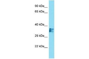 Host: Rabbit Target Name: C14orf79 Sample Type: Jurkat Whole Cell lysates Antibody Dilution: 1. (C14ORF79 抗体  (N-Term))