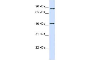 WB Suggested Anti-TXNDC13 Antibody Titration:  0. (TMX4 抗体  (C-Term))