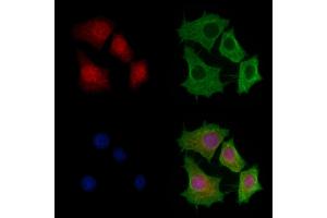 ABIN6257435 and ABIN6275362 staining HepG2 cells by IF/ICC. (Plakophilin 2 抗体  (N-Term))