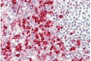 Human Spleen: Formalin-Fixed, Paraffin-Embedded (FFPE) (TRAM1 抗体  (AA 310-374))