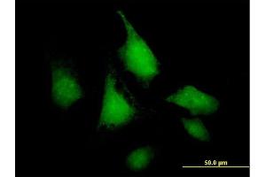 Immunofluorescence of purified MaxPab antibody to SNF1LK on HeLa cell. (SIK1 抗体  (AA 1-783))