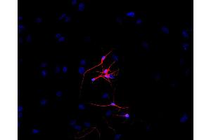 Immunofluorescence staining of P-19 mouse embryonal carcinoma cell line stimulated to neuronal differentiation by retinoic acid. (TUBB3 抗体  (N-Term))