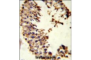 Formalin-fixed and paraffin-embedded human testis tissue reacted with ACR Antibody , which was peroxidase-conjugated to the secondary antibody, followed by DAB staining. (Achaete-scute complex protein T5 (AC) (AA 99-127) 抗体)