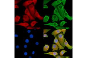 ABIN7095288 and ABIN7099345 staining Hela cells by IF/ICC.