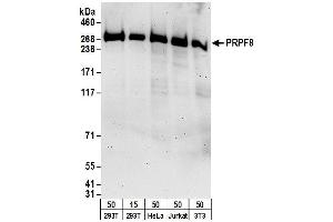 anti-PRP8 Pre-mRNA Processing Factor 8 (PRPF8) (AA 2285-2335) antibody