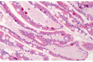 Human Small Intestine: Formalin-Fixed, Paraffin-Embedded (FFPE) (C1QTNF4 抗体  (C-Term))
