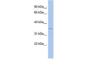 WB Suggested Anti-MAGEA9 Antibody Titration:  0. (MAGEA9 抗体  (Middle Region))