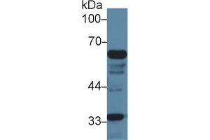 Detection of IkBz in Mouse Liver lysate using Polyclonal Antibody to Inhibitory Subunit Of NF Kappa B Zeta (IkBz) (Inhibitory Subunit of NF-KappaB zeta (AA 414-654) 抗体)