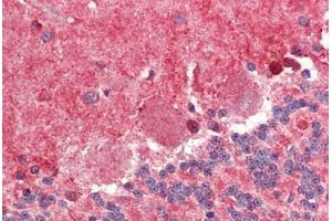 Brain, cerebellum, Human: Formalin-Fixed, Paraffin-Embedded (FFPE) (FABP7 抗体  (AA 101-111))