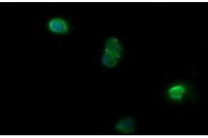 Image no. 3 for anti-NADPH Dependent Diflavin Oxidoreductase 1 (NDOR1) antibody (ABIN1499655) (NDOR1 抗体)