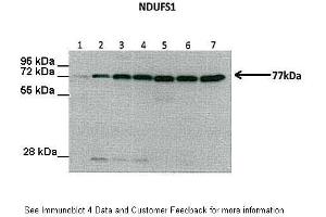 Western Blotting (WB) image for anti-NADH Dehydrogenase (Ubiquinone) Fe-S Protein 1, 75kDa (NADH-Coenzyme Q Reductase) (NDUFS1) (Middle Region) antibody (ABIN2786794)