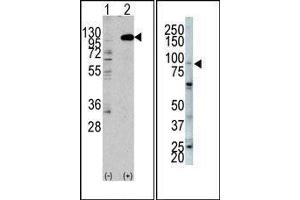 (LEFT) Western blot analysis of anti-hFGFR2-C808 Pab in 293 cell line lysates transiently transfected with the FGFR2 gene (2ug/lane). (FGFR2 抗体  (C-Term))