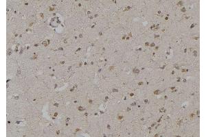 ABIN6269295 at 1/100 staining Human brain tissue by IHC-P. (14-3-3 zeta 抗体  (Internal Region))