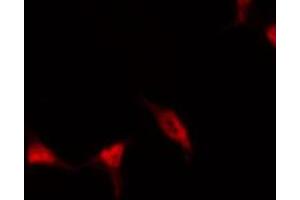 ABIN6267464 staining HeLa by IF/ICC. (CDC25A 抗体  (pSer178))