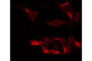 Immunofluorescence (fixed cells) (IF/ICC) image for anti-ATP-Binding Cassette, Sub-Family B (MDR/TAP), Member 7 (ABCB7) (N-Term) antibody (ABIN6257918)