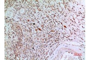 Immunohistochemistry (IHC) analysis of paraffin-embedded Human Brain, antibody was diluted at 1:100. (CD3D 抗体  (Internal Region))