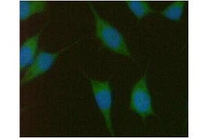 ICC/IF analysis of PMVK in PC3 cells line, stained with DAPI (Blue) for nucleus staining and monoclonal anti-human PMVK antibody (1:100) with goat anti-mouse IgG-Alexa fluor 488 conjugate (Green). (PMVK 抗体  (AA 1-192))