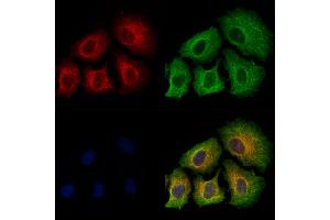 ABIN6256390 and ABIN6267486 staining Hela cells(4h of LPS treatment) by IF/ICC. (IRS1 抗体  (pSer639))