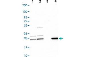 Western blot analysis of Lane 1: Human cell line RT-4 Lane 2: Human cell line U-251MG sp Lane 3: Human plasma (IgG/HSA depleted) Lane 4: Human liver tissue with CMPK1 polyclonal antibody  at 1:100-1:250 dilution. (Cytidine Monophosphate (UMP-CMP) Kinase 1, Cytosolic (CMPK1) 抗体)