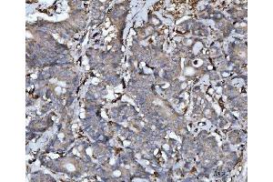 IHC analysis of Cathepsin B/CTSB using anti-Cathepsin B/CTSB antibody (ABIN7601692).