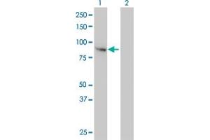 Western Blot analysis of FES expression in transfected 293T cell line by FES monoclonal antibody (M01), clone 3A3-1E5. (FES 抗体  (AA 1-822))