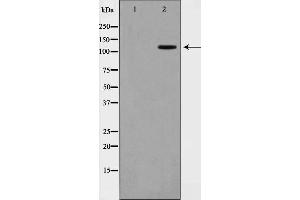 Western blot analysis on COS7 cell lysate using XRN2 Antibody,The lane on the left is treated with the antigen-specific peptide. (XRN2 抗体)