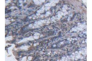 Detection of TOPBP1 in Mouse Colon Tissue using Polyclonal Antibody to Topoisomerase II Binding Protein 1 (TOPBP1) (TOPBP1 抗体  (AA 1-246))